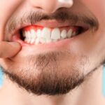 Understanding the Benefits of Regular Dental Check-Ups for Periodontal Health